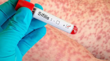 TDF es una de las provincias donde se registran más casos de sífilis
